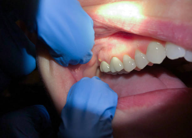 Best Cosmetic Emergency Dentistry in Wekiwa Springs, FL