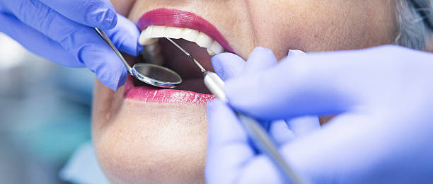 Best Emergency Dental Care for Broken or Chipped Teeth in Wekiwa Springs, FL